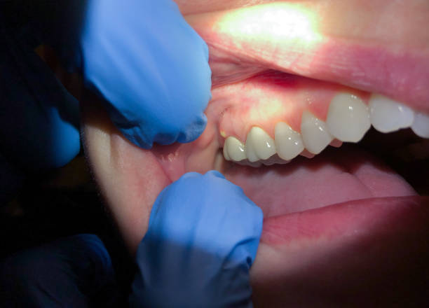 Best Pediatric Emergency Dentist in Cerro Gordo, IL